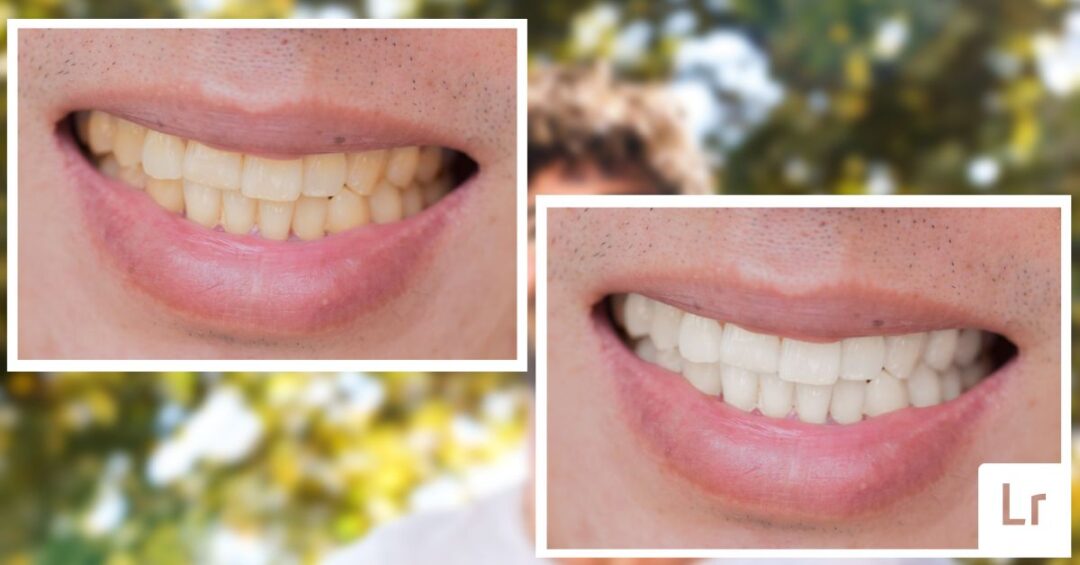 How To Whiten Teeth In Lightroom (Step By Step)